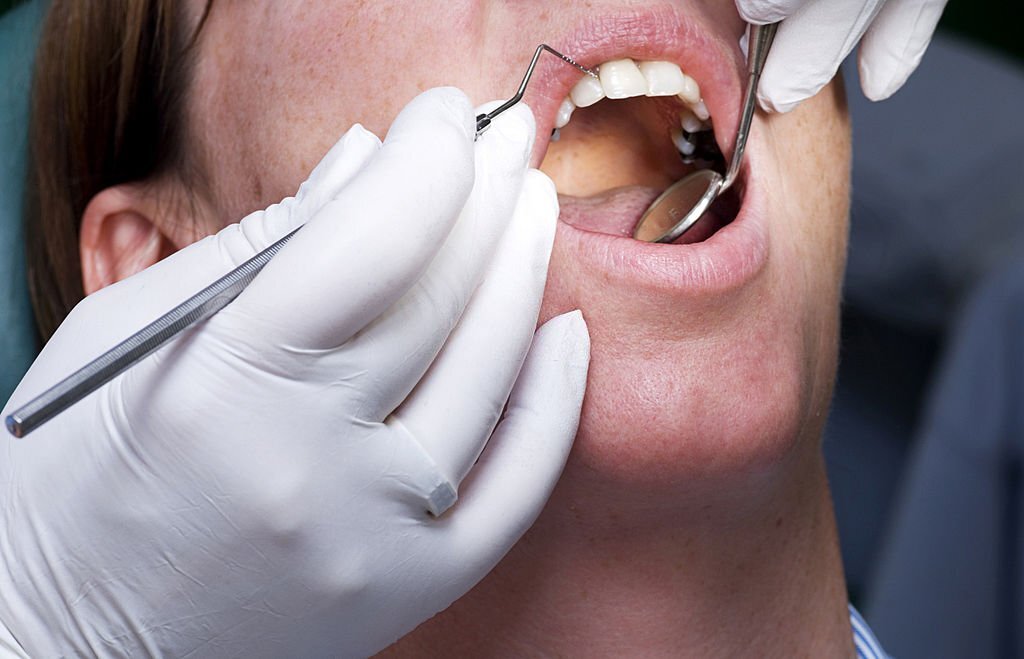 patient undergoing a dental examination